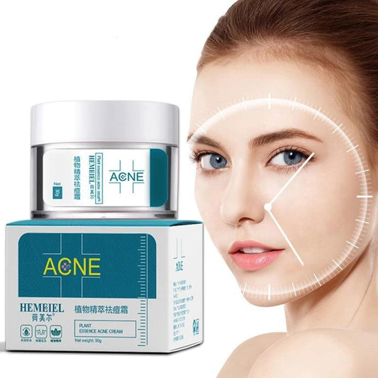 ACNE Herbal Extract Cream for Clear and Healthy Skin