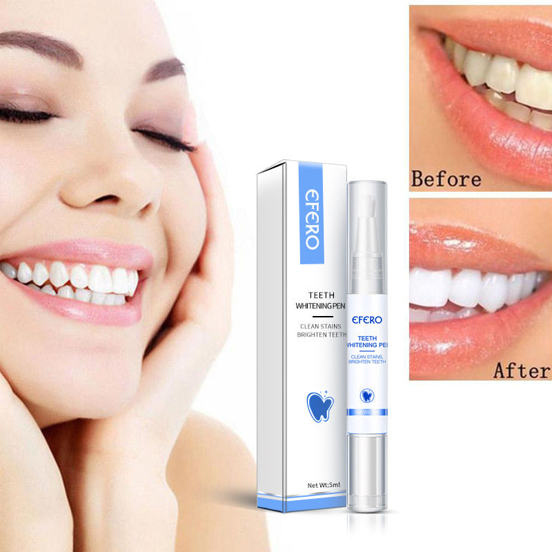 Onlineorderly™ Teeth Whitening Pen – Instant Stain Remover & Brightening Gel for a Whiter Smile