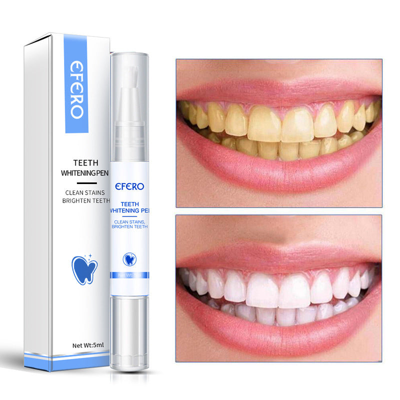 Onlineorderly™ Teeth Whitening Pen – Instant Stain Remover & Brightening Gel for a Whiter Smile